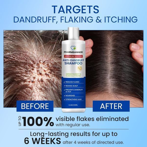 Шампунь против перхоти Pharmbanner Anti-Dandruff Shampoo with Selenium Sulfide 250 мл 2894996617 фото