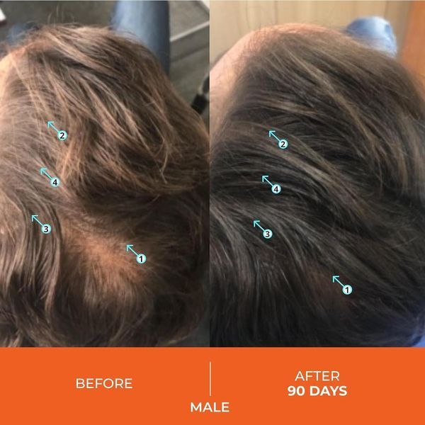 Шампунь для роста и укрепления волос с блокатором DHT премиум-класса DS Laboratories Revita Hair Density Shampoo 205 мл 2369818981 фото
